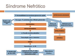 Síndrome Nefrótico
 