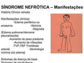 História Clínica variada
Manifestações clínicas:
-Edema periférico ou
anasarca -Nictúria
-Dispnéia
(Edema pulmonar/derrame
pleural/ascite)
-Aumento de peso p/edema
-Aumento de infecções
-TVP,TEP Trombose
arterial -Semiologia
mínima (só edema)
Sintomas da doença de base
SÍNDROME NEFRÓTICA – Manifestações
 