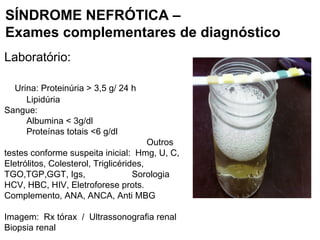 Laboratório:
Urina: Proteinúria > 3,5 g/ 24 h
Lipidúria
Sangue:
Albumina < 3g/dl
Proteínas totais <6 g/dl
Outros
testes conforme suspeita inicial: Hmg, U, C,
Eletrólitos, Colesterol, Triglicérides,
TGO,TGP,GGT, Igs, Sorologia
HCV, HBC, HIV, Eletroforese prots.
Complemento, ANA, ANCA, Anti MBG
Imagem: Rx tórax / Ultrassonografia renal
Biopsia renal
SÍNDROME NEFRÓTICA –
Exames complementares de diagnóstico
 