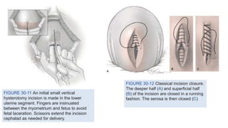 Giải phẫu sinh dục nữ. Female Reproductive Anatomy. | PPTX