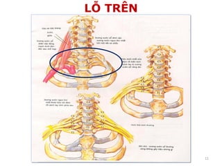 LỖ TRÊN
11
 