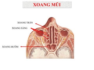 XOANG BƢỚM
XOANG SÀNG
XOANG TRÁN
XOANG MŨI
 