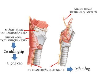 TK THANH QUẢN QUẶT NGƢỢC
NHÁNH TRONG
TK THANH QUẢN TRÊN
NHÁNH TRONG
TK THANH QUẢN TRÊN
NHÁNH NGOÀI
TK THANH QUẢN TRÊN
Cơ nhẫn giáp
Giọng cao
Mất tiếng
 