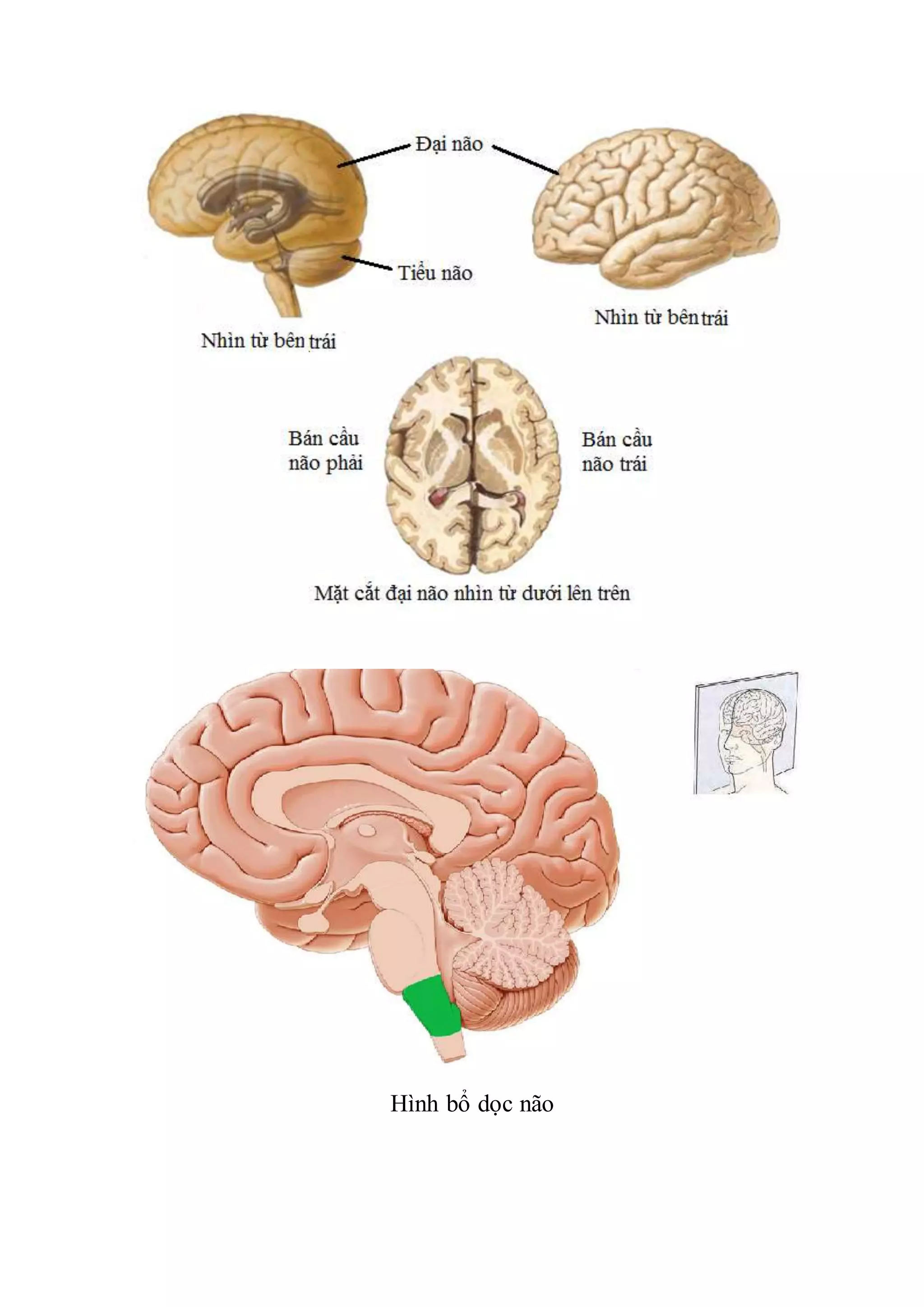 Hình bổ dọc não
 
