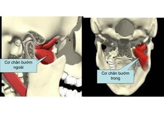 Cơ chân bướm
    ngoài
               Cơ chân bướm
                   trong
 