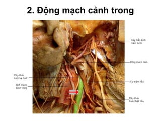 2. Động mạch cảnh trong
 