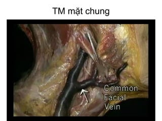 TM mặt chung
 