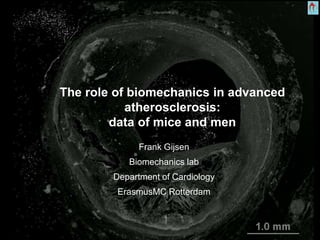 The role of biomechanics in advanced
atherosclerosis:
data of mice and men
Frank Gijsen
Biomechanics lab
Department of Cardiology
ErasmusMC Rotterdam
 