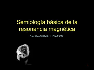 1
Semiología básica de la
resonancia magnética
Damián Gil Bello. UDIAT CD.
 