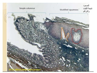 الصمود
الكبت نتيجة
والتراكم