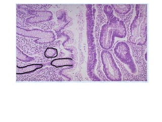 Gi lab