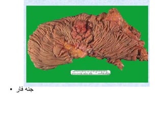 • ‫فار‬ ‫جنه‬
 