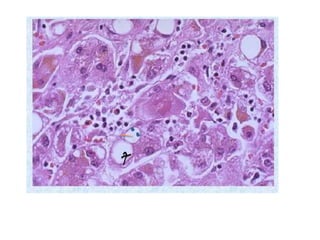 Gi lab