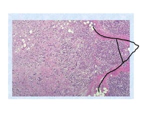 Gi lab