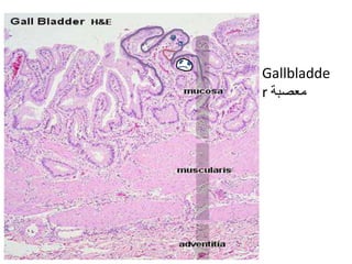 • Gallbladde
r ‫معصبة‬
 