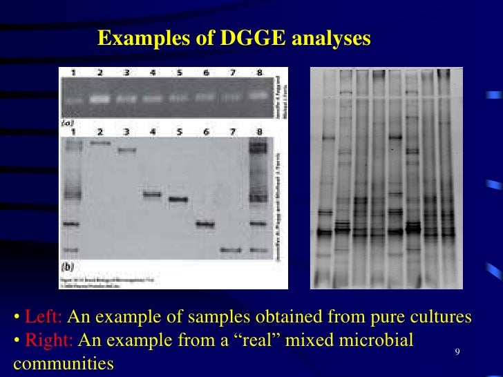 how does gel electrophoresis work