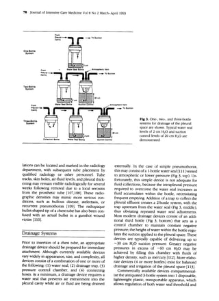 78 Journal of Intensive Care Medicine Vol 8 No 2 March-April 1993
From
Pleural-.-
Cavity
One-Bottle
System
From
Pleural---...