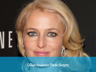 Gillian Anderson Plastic Surgery
 
