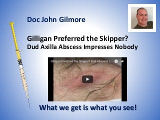 Gilligan Preferred the Skipper?
Dud Axilla Abscess Impresses Nobody
What we get is what you see!
Doc John Gilmore
 