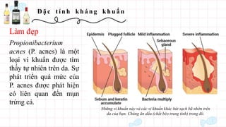 Đ ặ c t í n h kh á n g kh u ẩ n
Propionibacterium
acnes (P. acnes) là một
loại vi khuẩn được tìm
thấy tự nhiên trên da. Sự
phát triển quá mức của
P. acnes được phát hiện
có liên quan đến mụn
trứng cá.
Những vi khuẩn này và các vi khuẩn khác hút sạch bã nhờn trên
da của bạn. Chúng ăn dầu (chất béo trung tính) trong đó.
Làm đẹp
 