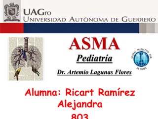 ASMA
Pediatría
Dr. Artemio Lagunas Flores
Alumna: Ricart Ramírez
Alejandra
 