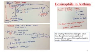 Eosinophils in Asthma
32
By targeting the interleukin receptor rather
than the cytokine; luminal depletion of
eosinophils can occur which maybe related to
greater clinical efficacy.
 