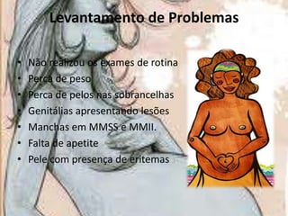 Levantamento de Problemas
•
•
•
•
•
•
•

Não realizou os exames de rotina
Perca de peso
Perca de pelos nas sobrancelhas
Genitálias apresentando lesões
Manchas em MMSS e MMII.
Falta de apetite
Pele com presença de eritemas

 