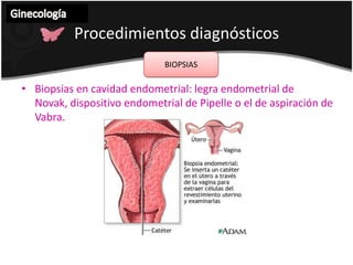 Ginecología Procedimientos diagnósticos  COLPOSCOPIATécnica que consiste en explorar el cérvix uterino bajo una lente de aumento para buscar lesiones displásicas o cáncer de cérvix.Aplicada a vulva se denomina VULVOSCOPIA y a vagina VAGINOSCOPIASe usan tinciones:Acético Lugol (test de Schiller)
