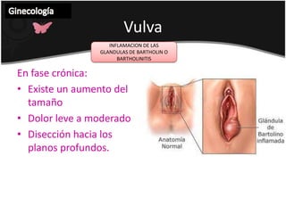 Ginecología VulvaANATOMIA Forma parte de los genitales externos