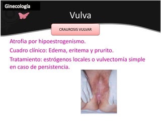 VulvaEn fase crónica:Existe un aumento del tamañoDolor leve a moderado Disección hacia los planos profundos.Ginecología INFLAMACION DE LAS GLANDULAS DE BARTHOLIN O BARTHOLINITIS