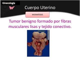 Exocervicales La mayoría son pediculados.Dx: visión directa.Hemorragia intermenstrual o poscoito