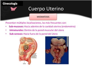CuelloUterinoGinecología TUMORES BENIGNOS MIOMAS:Menos del 8% de los uterinosCuando son únicos y pequeños, extraerlos por vía vaginal es sencillo.En caso de ser grandes, investigar por US y valorar el tratamiento y via de entrada.Tx: miomectomia ( cuando paciente desea continuar procreando)histerectomia en pacientes que no desean tener más hijos.