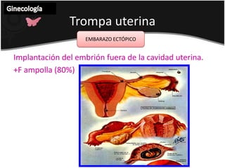 CuelloUterinoGinecología CARCINOMA CERVICOUTERINO  Diagnóstico y estadificación:Se disemina por vía linfática (paracervicaleso parametriales, ganglios en fosa obturador, cadena celiaca , paraaórticos)Diseminación directa en vagina.El sitio mas común de diseminación a distancia es a supraclaviculares.Para determinar el estadio es necesario una buena HC y exploración física, TRT y urografía excretora (evalúa extensión y metástasis)