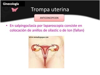 CuerpoUterinoGinecología POLIPOS ENDOMETRIALES +F >50 años.Pequeños.Pedículos largos, emergen de la vaginaPrincipal  síntoma es hemorragia