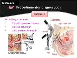 Anormalidades en la célula epitelial ( escamosa, glandular)
