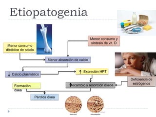 Etiopatogenia
Menor consumo
dietético de calcio
Menor consumo y
síntesis de vit. D
Menor absorción de calcio
Calcio plasmático
Excreción HPT
Deficiencia de
estrógenosRecambio y resorción óseos
Pérdida ósea
Formación
ósea
 