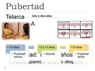 Pubertad
Telarca
MENARCA
Edad: 12 a 13 años
Puede aparecer antes o después
Uno o dos años
< 10 años
• Pubertad
precoz
12 a 13 años
• Normal
>15 años
• Pubertad
tardía
 