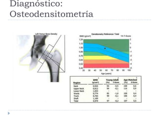 Diagnóstico:
Osteodensitometría
 