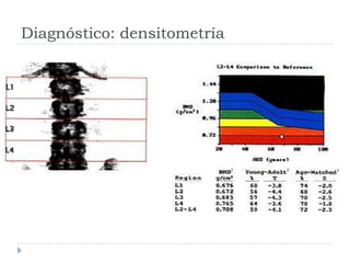 Diagnóstico: densitometría
 