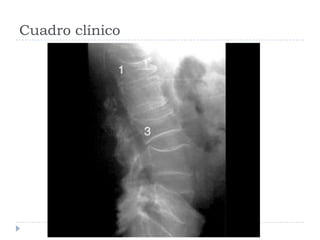Cuadro clínico
 