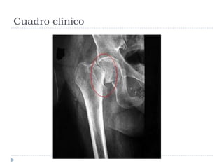 Cuadro clínico
 