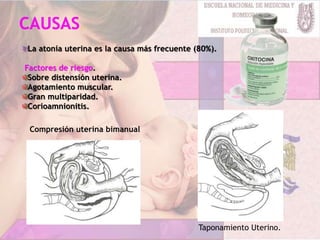 La atonía uterina es la causa más frecuente (80%).
Factores de riesgo.
Sobre distensión uterina.
Agotamiento muscular.
Gran multiparidad.
Corioamnionitis.
Compresión uterina bimanual
Taponamiento Uterino.
 