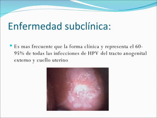 Enfermedad subclínica: Es mas frecuente que la forma clínica y representa el 60-95% de todas las infecciones de HPV del tracto anogenital externo y cuello uterino 