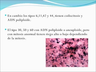 En cambio los tipos 6,11,42 y 44, tienen coilocitosis y ADN poliploide. El tipo 30, 50 y 60 con ADN poliploide o aneuploide, pero con mitosis anormal tienen riego alto o bajo dependiendo de la mitosis. 