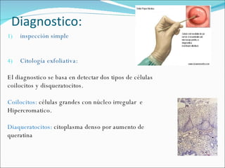Diagnostico: inspección simple Citología exfoliativa: El diagnostico se basa en detectar dos tipos de células coilocitos y disqueratocitos. Coilocitos:  células grandes con núcleo irregular  e Hipercromatico. Diaqueratocitos:  citoplasma denso por aumento de queratina 