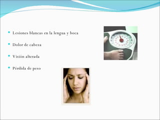Lesiones blancas en la lengua y boca Dolor de cabeza Visión alterada Pérdida de peso 