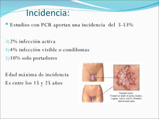 Incidencia: Estudios con PCR aportan una incidencia  del  5-53% 2% infección activa 4% infección visible o condilomas 10% solo portadores Edad máxima de incidencia  Es entre los 15 y 25 años 