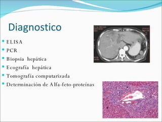 ELISA PCR Biopsia  hepática  Ecografía  hepática Tomografía computarizada Determinación de Alfa-feto-proteínas Diagnostico 