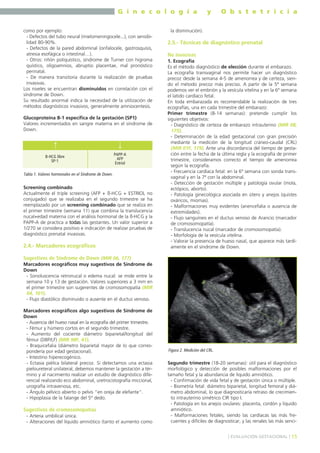 G i n e c o l o g í a
como por ejemplo:
- Defectos del tubo neural (mielomeningocele...), con sensibilidad 80-90%.
- Defectos de la pared abdominal (onfalocele, gastrosquisis,
atresia esofágica o intestinal…).
- Otros: riñón poliquístico, síndrome de Turner con higroma
quístico, oligoamnios, abruptio placentae, mal pronóstico
perinatal.
- De manera transitoria durante la realización de pruebas
invasivas.
Los niveles se encuentran disminuidos en correlación con el
síndrome de Down.
Su resultado anormal indica la necesidad de la utilización de
métodos diagnósticos invasivos, generalmente amniocentesis.
Glucoproteína B-1 específica de la gestación (SP1)
Valores incrementados en sangre materna en el síndrome de
Down.

↑

↓

B-HCG libre
SP-1

PAPP-A
AFP
Estriol

Tabla 1. Valores hormonales en el Síndrome de Down.

Screening combinado
Actualmente el triple screening (AFP + ß-HCG + ESTRIOL no
conjugado) que se realizaba en el segundo trimestre se ha
reemplazado por un screening combinado que se realiza en
el primer trimestre (semana 11) que combina la translucencia
nucal+edad materna con el análisis hormonal de la ß-HCG y la
PAPP-A de practica a todas las gestantes. Un valor superior a
1/270 se considera positivo e indicación de realizar pruebas de
diagnóstico prenatal invasivas.

2.4.- Marcadores ecográficos

y

O b s t e t r i c i a

la disminución).

2.5.- Técnicas de diagnóstico prenatal
No invasivas
1. Ecografía
Es el método diagnóstico de elección durante el embarazo.
La ecografía transvaginal nos permite hacer un diagnóstico
precoz desde la semana 4-5 de amenorrea y de certeza, siendo el método precoz más preciso. A partir de la 5ª semana
podemos ver el embrión y la vesícula vitelina y en la 6ª semana
el latido cardíaco fetal.
En toda embarazada es recomendable la realización de tres
ecografías, una en cada trimestre del embarazo:
Primer trimestre (8-14 semanas): pretende cumplir los
siguientes objetivos:
- Diagnóstico de certeza de embarazo intrauterino (MIR 08,
175).
- Determinación de la edad gestacional con gran precisión
mediante la medición de la longitud cráneo-caudal (CRL)
(MIR 01F, 179). Ante una discordancia del tiempo de gestación entre la fecha de la última regla y la ecografía de primer
trimestre, consideramos correcto el tiempo de amenorrea
según la ecografía.
- Frecuencia cardíaca fetal: en la 6º semana con sonda transvaginal y en la 7ª con la abdominal.
- Detección de gestación múltiple y patología ovular (mola,
ectópico, aborto).
- Patología ginecológica asociada en útero y anejos (quistes
ováricos, miomas).
- Malformaciones muy evidentes (anencefalia o ausencia de
extremidades).
- Flujo sanguíneo en el ductus venoso de Arancio (marcador
de cromosomopatía).
- Translucencia nucal (marcador de cromosomopatía).
- Morfología de la vesícula vitelina.
- Valorar la presencia de hueso nasal, que aparece más tardíamente en el síndrome de Down.

Sugestivos de Síndrome de Down (MIR 06, 177)
Marcadores ecográficos muy sugestivos de Síndrome de
Down
- Sonoluscencia retronucal o edema nucal: se mide entre la
semana 10 y 13 de gestación. Valores superiores a 3 mm en
el primer trimestre son sugerentes de cromosomopatía (MIR
04, 101).
- Flujo diastólico disminuido o ausente en el ductus venoso.
Marcadores ecográficos algo sugestivos de Síndrome de
Down
- Ausencia del hueso nasal en la ecografía del primer trimestre.
- Fémur y húmero cortos en el segundo trimestre.
- Aumento del cociente diámetro biparietal/longitud del
fémur (DBP/LF) (MIR 98F, 41).
- Braquicefalia (diámetro biparietal mayor de lo que correspondería por edad gestacional).
- Intestino hiperecogénico.
- Ectasia piélica bilateral precoz. Si detectamos una ectasia
pieloureteral unilateral, debemos mantener la gestación a término y al nacimiento realizar un estudio de diagnóstico diferencial realizando eco abdominal, uretrocistografía miccional,
urografía intravenosa, etc.
- Ángulo pélvico abierto o pelvis "en oreja de elefante".
- Hipoplasia de la falange del 5º dedo.

Sugestivos de cromosomopatías
- Arteria umbilical única.
- Alteraciones del líquido amniótico (tanto el aumento como

Figura 2. Medición del CRL.

Segundo trimestre (18-20 semanas): útil para el diagnóstico
morfológico y detección de posibles malformaciones por el
tamaño fetal y la abundancia de líquido amniótico.
- Confirmación de vida fetal y de gestación única o múltiple.
- Biometría fetal: diámetro biparietal, longitud femoral y diámetro abdominal, lo que diagnosticaría retraso de crecimiento intrauterino simétrico CIR tipo I.
- Patología en los anejos ovulares: placenta, cordón y líquido
amniótico.
- Malformaciones fetales, siendo las cardíacas las más frecuentes y difíciles de diagnosticar, y las renales las más senci] EVALUACIÓN GESTACIONAL [ 15

 