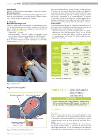 Manual A Mir

www.academiamir.com

Indicaciones
Registro cardiotocográfico no estresante no reactivo o dudoso.
Contraindicaciones
Placenta previa, desprendimiento prematuro de placenta, amenaza de parto pretérmino, cicatrices uterinas (cesáreas anteriores o miomectomías con apertura de cavidad).
2. Intraparto
Microtoma de sangre fetal
Sirve para medir el pH de sangre fetal. Se realiza ante situaciones de sospecha de acidosis: registro patológico (ondulatoria
baja o saltatoria), oligoamnios, líquido amniótico teñido de
meconio, etc. (MIR 00F, 182).
- pH normal: 7.25-7.45.
- pH prepatológico: 7.25-7.20. Es indicación de repetir microtoma de sangre fetal para nueva valoración en 15-30 minutos.
- pH patológico: inferior a 7.20. Extracción fetal inmediata.
Es el parámetro más seguro para diagnosticar el sufrimiento
fetal intraparto (MIR 04, 94).

Para valorar bienestar fetal durante la dilatación y el expulsivo.
Si la rotura de membranas ya se ha producido y hay dilatación
cervical suficiente, se puede realizar monitorización interna, es
decir, con un electrodo aplicado en el scalp fetal y un catéter
de dinámica introducido en la cavidad amniótica (el registro
que se hace anteparto se realiza con transductores externos,
aplicados al abdomen de la madre, que miden la FCF y las contracciones y es menos preciso que la monitorización interna).
Pulsioximetría
Consiste en medir el estado de oxigenación fetal mediante la
colocación de un pulsioxímetro (sensor en contacto con la piel
fetal). Se requiere cierta dilatación uterina (3-4 cm).
- Normal: valores de saturación de oxígeno entre 30 y 60%.
- Patológicos: saturación de oxígeno inferior al 30%: indican
acidosis fetal. Se debe hacer una microtoma de sangre fetal.
- Si los valores son inferiores a 10% está indicada la extracción fetal inmediata.
BUEN
PRONÓSTICO

PRONÓSTICO
INTERMEDIO

MAL
PRONÓSTICO

FRECUENCIA
CARDÍACA
FETAL

120-160

> 160
Descartar
fiebre materna

<120
Descartar
hipoglucemia
o sueño fetal

VARIABILIDAD

Normal (10-25)

Baja (5-10)

Silente (<5) o
sinusoidal

ASCENSOS O
ACELERACIONES

Presentes

Ausentes

Ausentes

DIP I
(sincronía con la
contracción,
DECELERACIONES
compresión
cefálica)

DIP umbilicales
DIP II.
(decalaje variable, (decalaje 10-40 s
compresión
Hipoxia fetal)
cordón)

PH
SANGRE FETAL

7.25-7.45
(normal)

7.25 - 7.20
(prepatológico;
repetir pH en
15-30 min)

<7.20
(patológico)
Extracción fetal
inmediata

PULSIOXIMETRÍA

30-60%

<30-10%

<10%

Tabla 4. Evaluación del bienestar fetal.

Figura 9. Microtoma fetal.

Registro cardiotocográfico

TEMA 3
Electrodo interno para FCF

Catéter interno de dinámica

HEMORRAGIAS
DEL PRIMER
TRIMESTRE
ENFOQUE MIR

Es muy importante saber hacer el diagnóstico diferencial entre
las tres entidades (fundamental la tabla que se incluye en el
tema), al igual que el manejo y las posibles complicaciones.

3.1.- Aborto
Concepto

El electrodo se inserta en el
cuero cabelludo fetal
mediante una espiral

Figura 10. Monitorización cardiotocográfica interna.

18 ] HEMORRAGIAS DEL PRIMER TRIMESTRE [

El aborto se produce cuando se interrumpe la gestación antes
de la 22 semana. En más del 80% de los casos ocurre antes de
la semana 12, denominándose entonces aborto precoz, mientras que si ocurre entre la 12-22 semana se denomina aborto
tardío.
Es difícil determinar su incidencia debido a que muchas mujeres abortan sin darse cuenta. La frecuencia de aborto clínico es
de aproximadamente el 10%. El riesgo aumenta con el aumento de edad de los progenitores y con el número de embarazos.

 